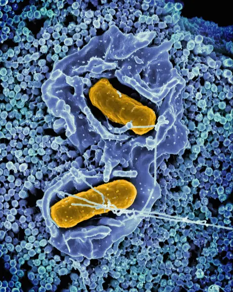 Bacteria under an electron microscope